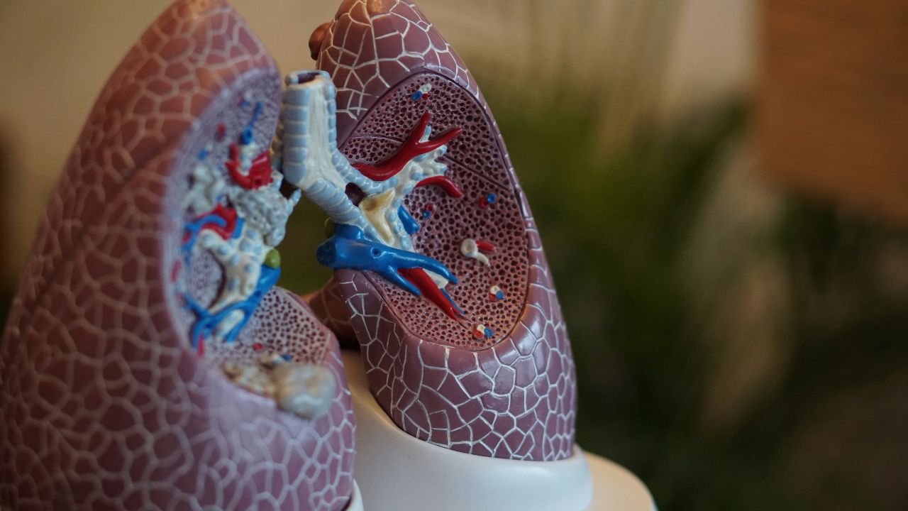 Mesothelioma